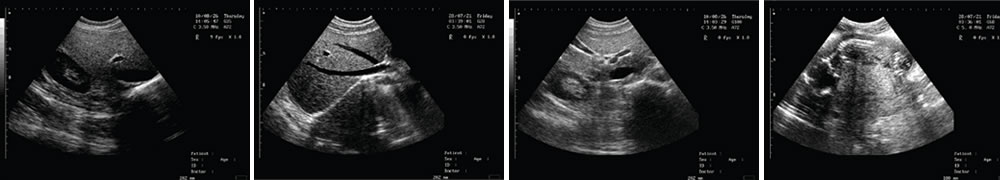 V-218全數(shù)字筆記本式動物超聲診斷儀(動物版)一流的數(shù)字成像技術，圖像更清晰